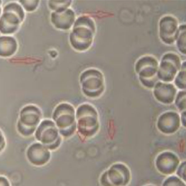 Watch This Video of a White Blood Cell VERSUS Yeast!
